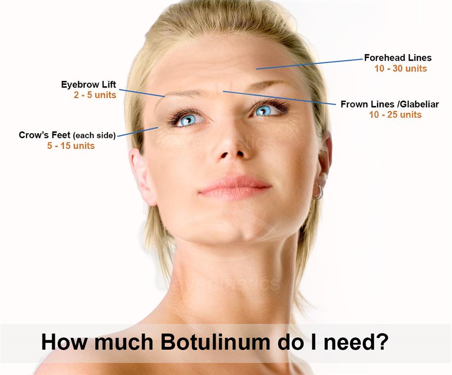 Illustration showing the cosmetic uses of Botulinum, with embedded text 'How Much Botulinum'